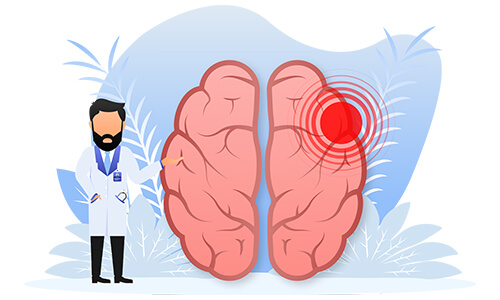 concussion